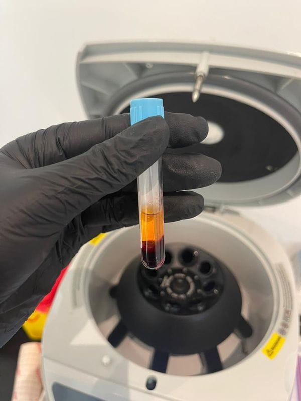 Centrifugeuse
