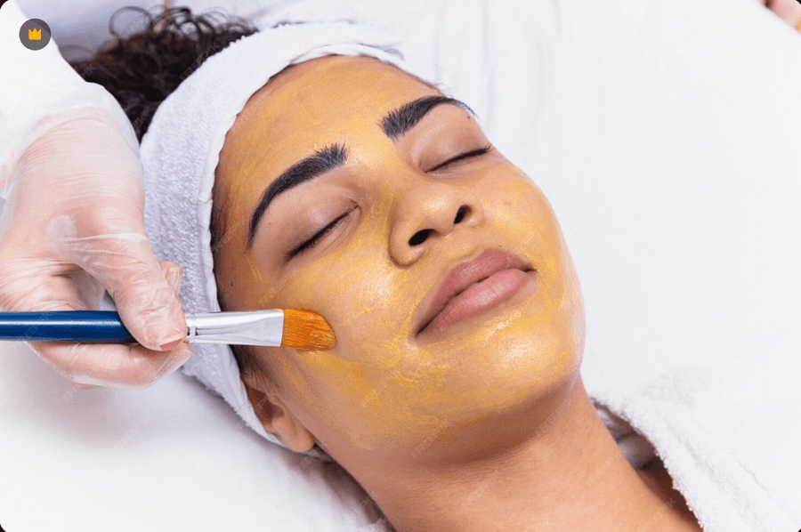 Peeling Chimique